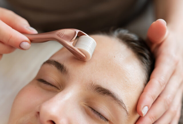 Woman receiving a microneedling treatment on her forehead for scars